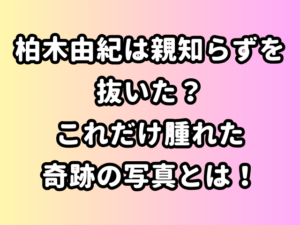 柏木由紀は親知らずを抜いた？これだけ腫れた奇跡の写真とは！